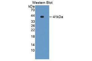 Western blot analysis of the recombinant protein. (NR1H3 Antikörper  (AA 93-432))