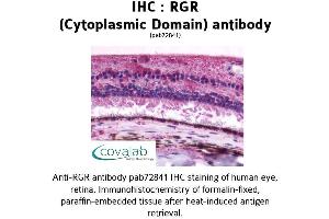 Image no. 1 for anti-Retinal G Protein Coupled Receptor (RGR) (3rd Cytoplasmic Domain) antibody (ABIN1738848) (RGR Antikörper  (3rd Cytoplasmic Domain))