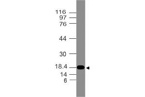 Image no. 1 for anti-Filaggrin Family Member 1 (FLG1) (AA 1-300) antibody (ABIN5027200) (Filaggrin-1 Antikörper  (AA 1-300))
