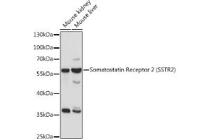 Western blot analysis of extracts of various cell lines, using Somatostatin Receptor 2 (SSTR2) antibody (ABIN7270493) at 1:1000 dilution. (SSTR2 Antikörper  (C-Term))