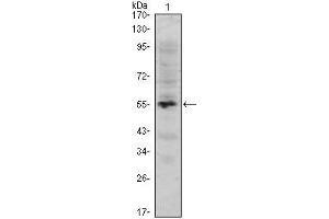 Western Blot showing MUM1 antibody used against human MUM1 (AA: 590-711) recombinant protein. (MUM1 Antikörper)