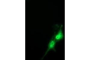 Anti-FAM84B mouse monoclonal antibody (ABIN2453031) immunofluorescent staining of COS7 cells transiently transfected by pCMV6-ENTRY FAM84B (RC207996). (FAM84B Antikörper)
