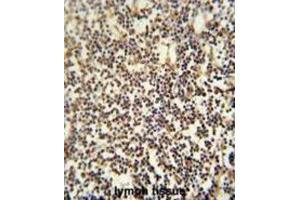 Immunohistochemistry (IHC) image for anti-PARP1 Binding Protein (PARPBP) antibody (ABIN2995516) (PARPBP Antikörper)