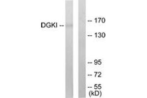 Western blot analysis of extracts from 293 cells, using DGKI Antibody.