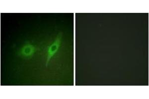 Immunofluorescence analysis of HeLa cells, using Collagen IV alpha2 Antibody. (COL4a2 Antikörper  (AA 151-200))