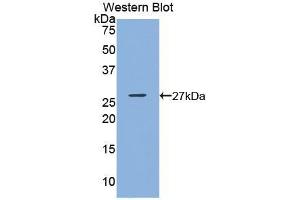 Detection of Recombinant GSTk1, Mouse using Polyclonal Antibody to Glutathione S Transferase Kappa 1 (GSTk1) (GSTK1 Antikörper  (AA 19-222))