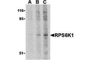 Western Blotting (WB) image for anti-RPS6K1 (C-Term) antibody (ABIN1030629) (RPS6K1 (C-Term) Antikörper)