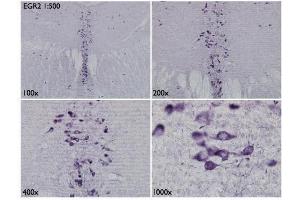 IHC-Fr Image Immunohistochemical analysis of mouse brain tissue (paraformaldehyde-fixed frozen sections), using EGR2, antibody at 1:500 dilution. (EGR2 Antikörper)