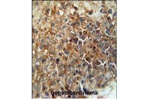 Immunohistochemistry (Paraffin-embedded Sections) (IHC (p)) image for anti-CD46 (CD46) (AA 317-343), (C-Term) antibody (ABIN650982)