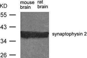 Western blot analysis of extract from rat brain and mouse brain using synaptophysin 2 Antibody. (Synaptoporin Antikörper)