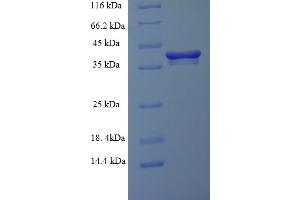 SDS-PAGE (SDS) image for RAB6A, Member RAS Oncogene Family (RAB6A) (AA 2-208) protein (His-SUMO Tag) (ABIN5710211) (RAB6A Protein (AA 2-208) (His-SUMO Tag))
