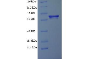 SDS-PAGE (SDS) image for RAB6A, Member RAS Oncogene Family (RAB6A) (AA 2-208) protein (His-SUMO Tag) (ABIN4974503)
