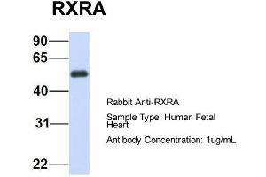 Host:  Rabbit  Target Name:  RXRA  Sample Type:  Human Fetal Heart  Antibody Dilution:  1. (Retinoid X Receptor alpha Antikörper  (N-Term))