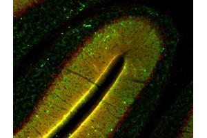 Indirect immunolabeling of mouse cerebellum section with anti-homer 3 (dilution 1 : 500; red) and anti-synapsin (, dilution 1 : 500; green). (HOMER3 Antikörper  (AA 1-177))
