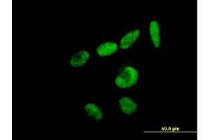 Immunofluorescence of purified MaxPab antibody to RBM15 on HeLa cell.
