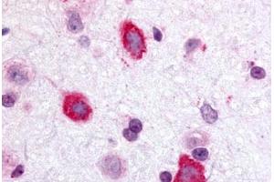 Anti-GALR3 antibody  ABIN1048648 IHC staining of rat brain, hippocampus. (GALR3 Antikörper  (Cytoplasmic Domain))