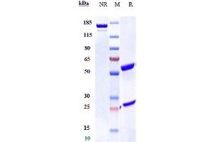 Anti-TNFRSF12A / TWEAKR / CD266 Reference Antibody (enavatuzumab) on SDS-PAGE under reducing (R) condition.