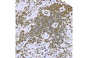 IHC analysis of Histone H1.