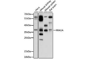 Western blot analysis of extracts of various cell lines, using RRAGA antibody (ABIN6293916) at 1:1000 dilution. (RRAGA Antikörper)