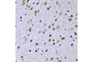 Immunohistochemistry of paraffin-embedded mouse brain using SOX5 antibody (ABIN5974201) at dilution of 1/100 (40x lens). (SOX5 Antikörper)