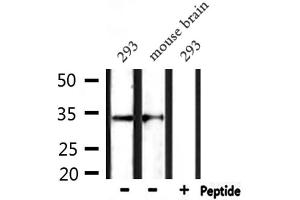 Western blot analysis of extracts from 293 and mouse brain, using CD38 Antibody. (CD38 Antikörper  (Internal Region))