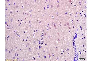 Formalin-fixed and paraffin embedded rat brain labeled with Anti-SRRM2 Polyclonal Antibody, Unconjugated (ABIN873267) at 1:200 followed by conjugation to the secondary antibody and DAB staining. (SRRM2 Antikörper  (AA 101-230))