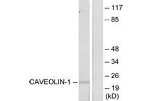 Western blot analysis of extracts from NIH-3T3 cells, using Caveolin-1 (Ab-14) Antibody. (Caveolin-1 Antikörper  (AA 5-54))