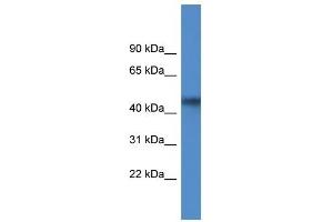 Western Blot showing AGPAT4 antibody used at a concentration of 1 ug/ml against MCF7 Cell Lysate (AGPAT4 Antikörper  (Middle Region))