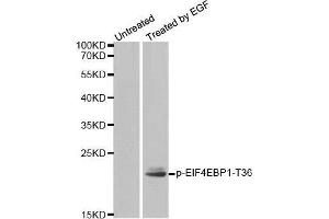 Western blot analysis of extracts from MDA-MB-435 cells, using Phospho-EIF4EBP1-T36 antibody. (eIF4EBP1 Antikörper  (pThr36))
