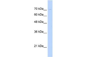 WB Suggested Anti-KIAA1333 Antibody Titration:  0. (G2E3 Antikörper  (N-Term))