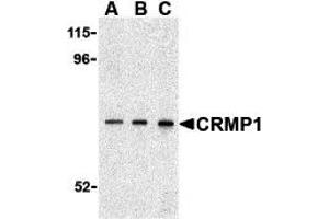 Western Blotting (WB) image for anti-Collapsin Response Mediator Protein 1 (CRMP1) (C-Term) antibody (ABIN1030345) (CRMP1 Antikörper  (C-Term))