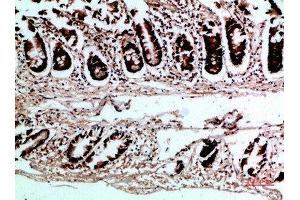 Immunohistochemical analysis of paraffin-embedded human-colon, antibody was diluted at 1:200