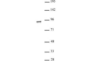 NR3C1 antibody (pAb) tested by Western blot. (Glucocorticoid Receptor Antikörper)