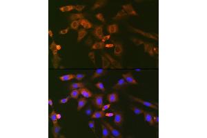 Immunofluorescence analysis of NIH-3T3 cells using Ube2N/Ubc13 Rabbit mAb (ABIN7271179) at dilution of 1:100 (40x lens). (UBE2N Antikörper)