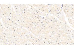 Immunohistochemistry (IHC) image for anti-Lysyl Oxidase (LOX) (AA 213-417) antibody (ABIN7435016)