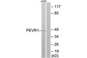 Western Blotting (WB) image for anti-G Protein-Coupled Receptor 172A (GPR172A) (AA 43-92) antibody (ABIN2891074) (GPR172A Antikörper  (AA 43-92))