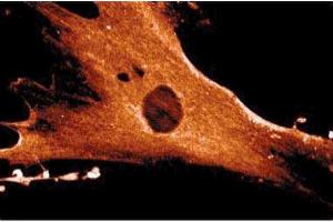 Immunofluorescence staining of WI-38 cells (Human lung fibroblasts, ATCC CCL-75).