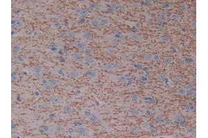 DAB staining on IHC-P; Samples: Rat Cerebrum Tissue (CYP7A1 Antikörper  (AA 109-383))