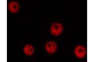 ABIN6276953 staining Hela by IF/ICC.