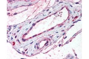 Immunohistochemical (Formalin/PFA-fixed paraffin-embedded sections) staining in vessels of human testis. (ADAMTS1 Antikörper)