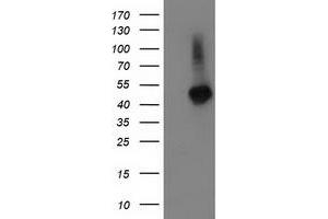Image no. 1 for anti-Tubulin Folding Cofactor E-Like (TBCEL) antibody (ABIN1501325) (TBCEL Antikörper)