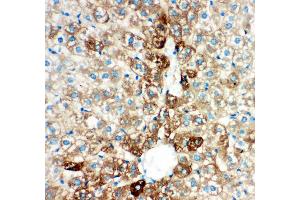 Immunohistochemistry (IHC) image for anti-Cytochrome P450, Family 2, Subfamily E, Polypeptide 1 (CYP2E1) (AA 1-310) antibody (ABIN3043821)