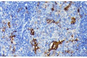 Immunohistochemistry of paraffin-embedded Mouse spleen using TIAL1 Polyclonal Antibody at dilution of 1:100 (40x lens). (TIAL1 Antikörper)