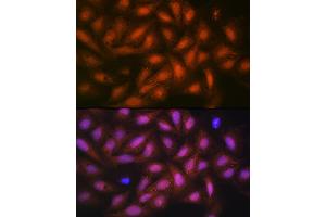 Immunofluorescence (IF) image for anti-Protein Phosphatase 1, Catalytic Subunit, beta Isoform (PPP1CB) antibody (ABIN1679819)