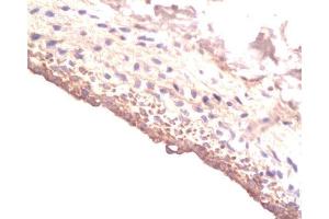 Formalin-fixed and paraffin-embedded rat Carotid artery labeled with Rabbit Anti-IGF-I Polyclonal Antibody , Unconjugated at 1:200 followed by conjugation to the secondary antibody and DAB staining