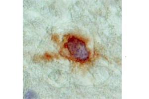 mouse and rat brain (SLC18A2 Antikörper  (N-Term))