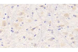 Detection of NRG1 in Mouse Cerebrum Tissue using Polyclonal Antibody to Neuregulin 1 (NRG1) (Neuregulin 1 Antikörper  (AA 54-163))