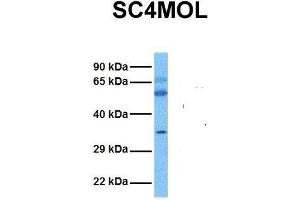 Host:  Rabbit  Target Name:  SC4MOL  Sample Tissue:  Human Ovary Tumor  Antibody Dilution:  1. (SC4MOL Antikörper  (N-Term))