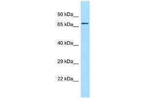 WB Suggested Anti-SGPL1 Antibody Titration: 1. (SGPL1 Antikörper  (C-Term))
