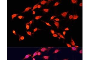 Immunofluorescence analysis of C6 cells using TriMethyl-Histone H3-K14 Polyclonal Antibody at dilution of 1:100 (40x lens). (Histone 3 Antikörper  (3meLys14))